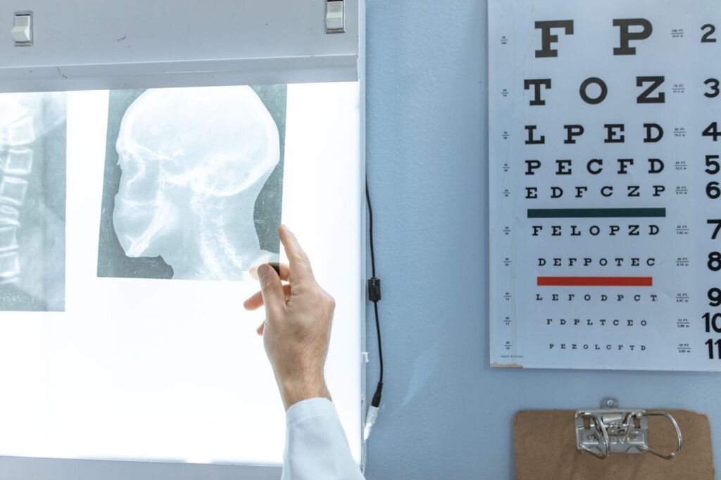 Doctor reviewing diagnostic X-rays